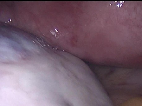PCOD Driling