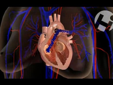 Normal Cardiac Anatomy and Physiology
