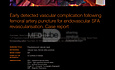 MEDtube Science 2014 - Early detected vascular complication following femoral artery puncture for endovascular SFA revascularisation. Case report