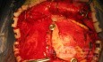 Craniotomy Tools and Procedures