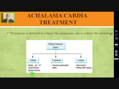 Achalasia Cardia - Dysphagia