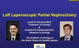 Left Laparoscopic Partial Nephrectomy - Part 1