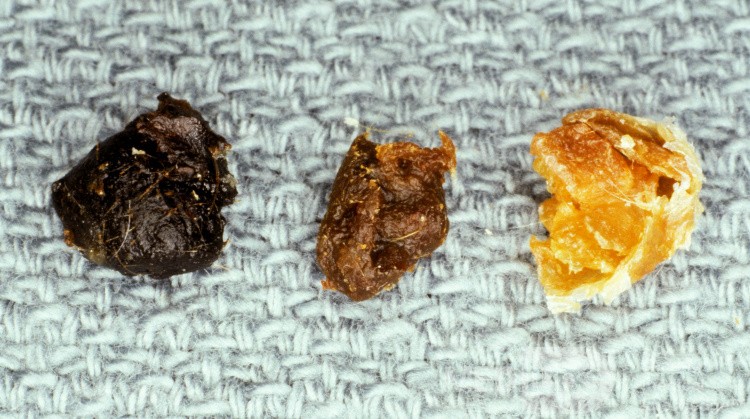 The Colours of Cerumen