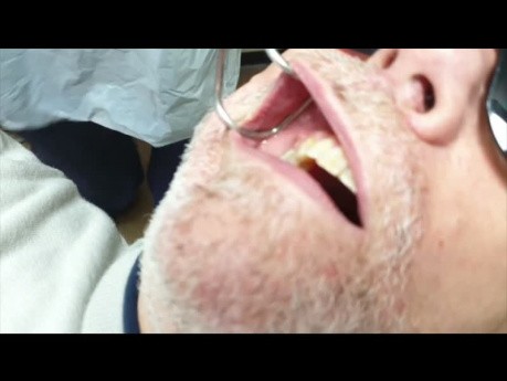 How to Take Posterior Quadrant Dental Photographs