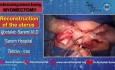 Adenomyomectomy