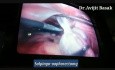 Laparoscopic Surgery for Torsion with Dense Adhesion Ovarian Cyst