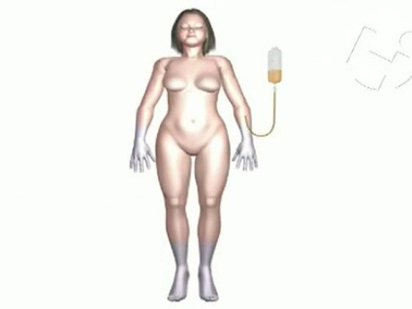 Dopamine vs Dobutamine