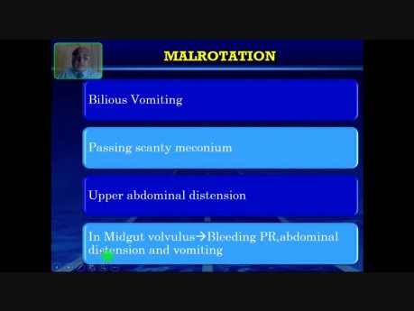 Neonatal Bilious Vomiting - 1