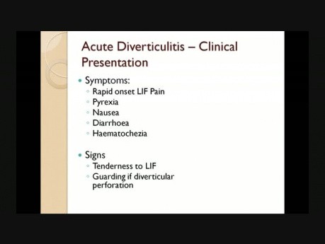 Surgical Emergencies – Lecture 4 – Diverticular Disease & Diverticulitis