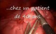 Invaginated Meckel Diverticulum In Laparoscopic View
