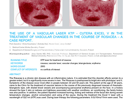 MEDtube Science 2019 - The use of a vascular laser KTP – Cutera Excel V in the treatment of vascular changes in the course of rosacea – a case report