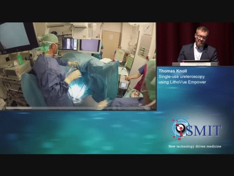 Single-use Ureteroscopy Using LithoVue Empower - SMIT 2019
