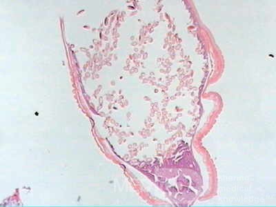 Trichuris Trichuris (whipworm) (11 of 19)