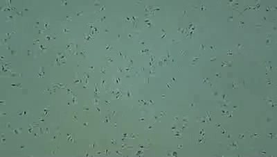 Normal sperm