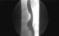 The Esophageogastrointestinal Sphincters