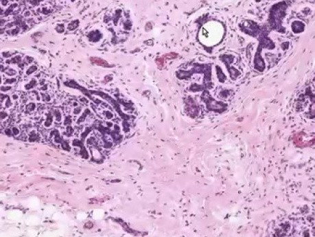 Inactive Breast - Histology