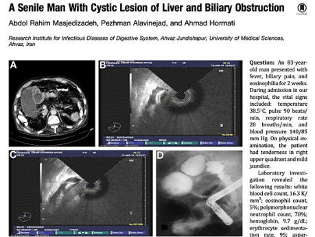 A Senile Man with Cystic Lesion of Liver