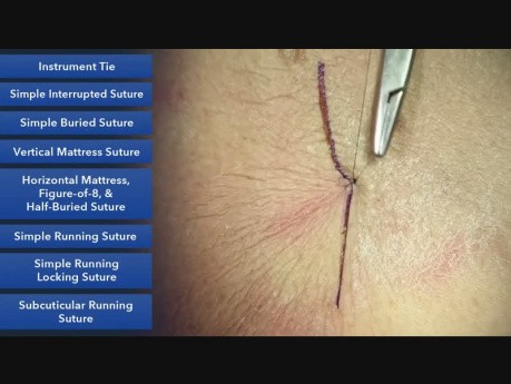 Instrument Tie - Suture Techniques