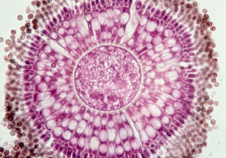 Aspergillus Niger Fruiting Head [histology] • Image • MEDtube.net