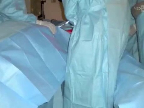 Minimally Invasive Colon Management