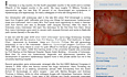 Hysteroscopy Newsletter Vol 3 Issue 1