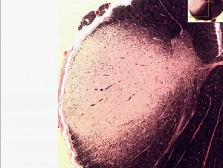 Normal corpus albicans
