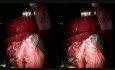 medVC - Live surgical session France-Finland 2016