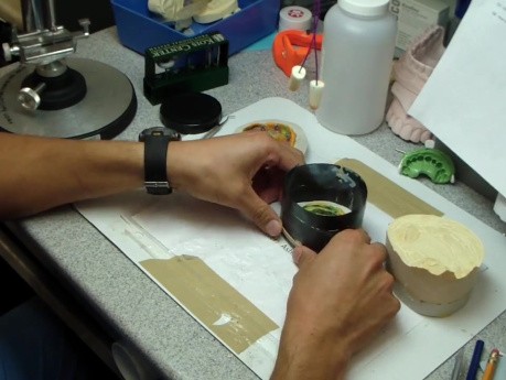 Final Denture Impression Part 2: Boxing With A Panoramic Radiograph- No Wax, Mo Mess.