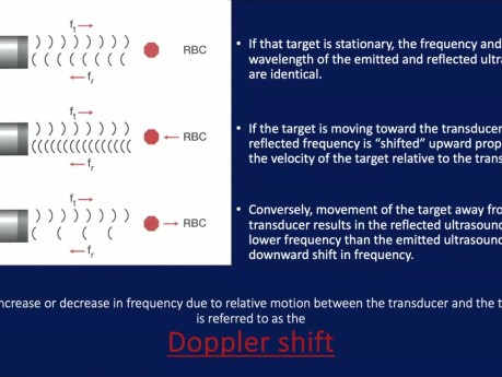 Echo Core Curriculum: Basics of Echo Doppler (Part 1)