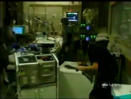 The Potential of ECMO - Usefullness in Treatment for Severe H1N1 Infection