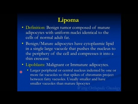 Orthopedic Oncology and Pathology Course - Benign Soft Tissue Tumors (Lipoma, etc) - Lecture 9