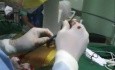 Percutaneous Nephrolithotomy - kidney stones removal