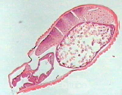 Trichuris Trichuris (whipworm) (14 of 19)