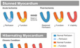Myocardial Viability