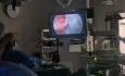 Herniolap tapp plus chollap in a single surgical procedure