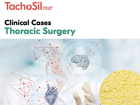 TachoSil® Clinical Cases Thoracic Surgery
