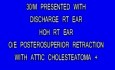 Cholesteatoma - The Complete Spectrum