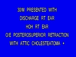 Cholesteatoma - The Complete Spectrum