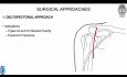 Scapula Fracctures