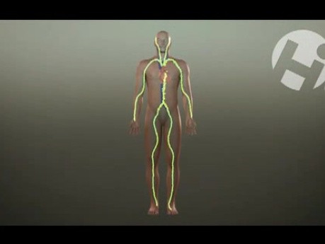 Complications of Injury from Mevacor