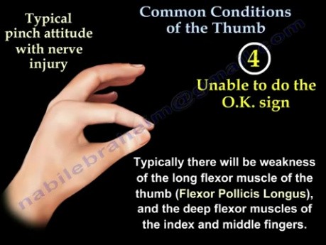 Common Conditions Of The Thumb 