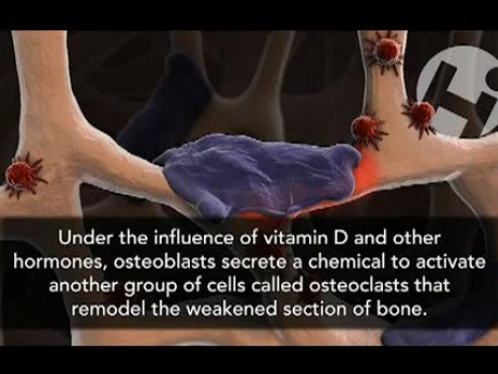 Cancellous Bone Growth