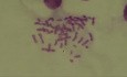 Human chromosomes - Karyotype