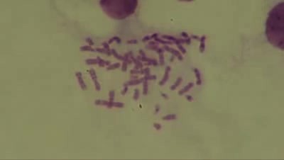 Human chromosomes - Karyotype