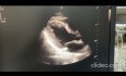 16. Echocardiography Case - What You See?