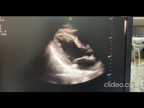 16. Echocardiography Case - What You See?
