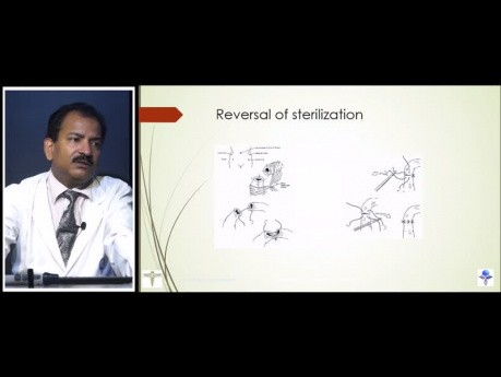 Laparoscopic Sterilization Lecture by Dr R K Mishra
