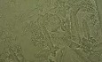 Urina - Salt crystals - 2