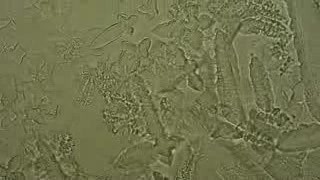 Urina - Salt crystals - 2