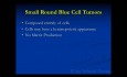 Orthopedic Oncology Course- Small Round Blue Cell Tumors (Ewing Sarcoma, Lymphoma) - Lecture 8